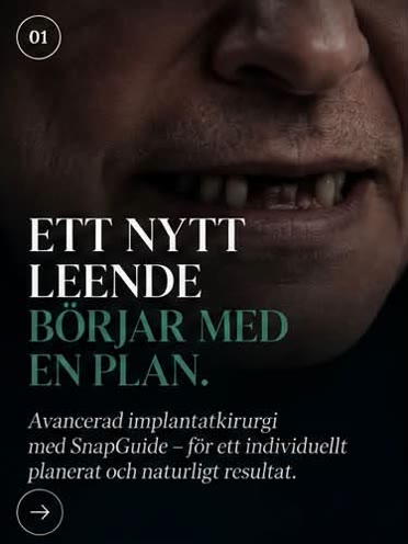 Steg 1: Ett nytt leende börjar med en plan. Avancerad implantatkirurgi med SnapGuide för ett individuellt planerat och naturligt resultat.