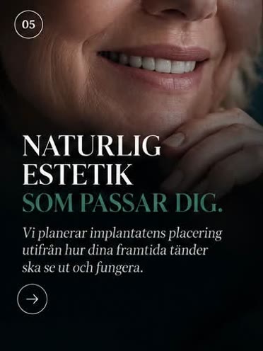 Steg 5: Naturlig estetik som passar dig. Implantatens placering planeras utifrån hur dina framtida tänder ska se ut och fungera.